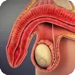 Sexual Dysfunction
